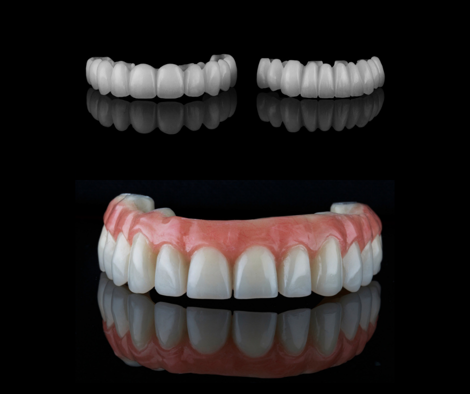 Temporary Dentures vs. Permanent Dentures - Pickett Family Dental